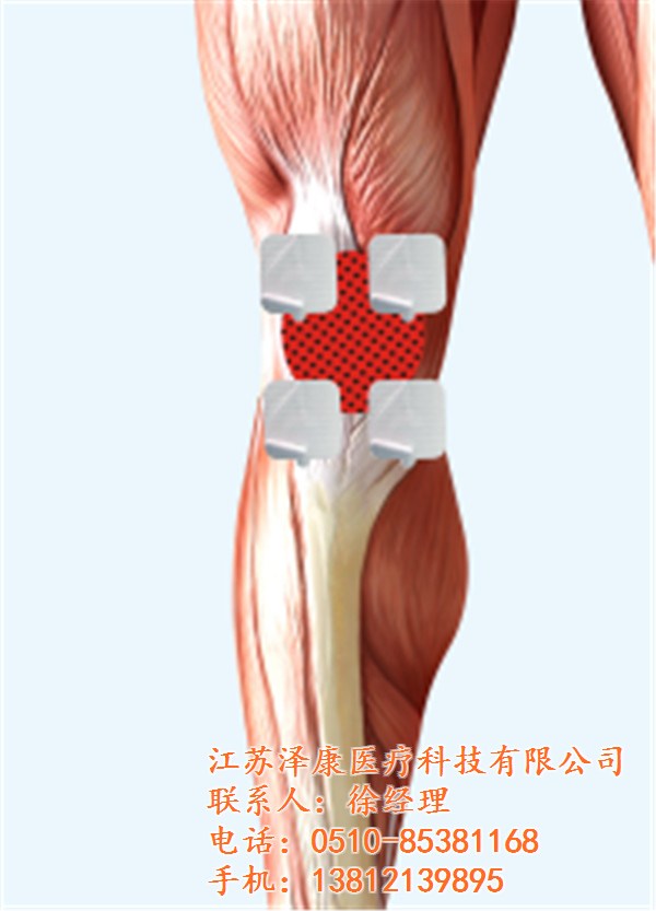 福建理疗粘贴电极片_江苏泽康_理疗粘贴电极片厂家