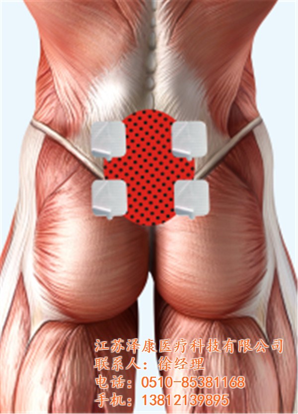 浙江理疗粘贴电极片|江苏泽康|理疗粘贴电极片供应商